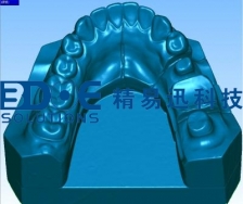 牙齿相关扫描案例——牙模三维扫描案例